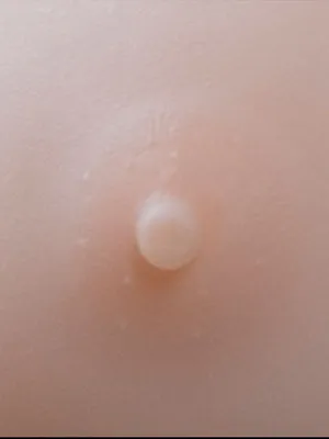 Skin Tone